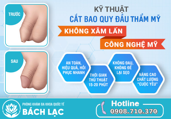 kỹ thuật cắt bao quy đầu hiện đại