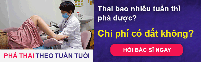 chi phí phá thai buôn ma thuột