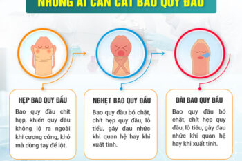 Cắt Bao Quy Đầu Ở Buôn Ma Thuột Địa Chỉ Nào Tốt? Cơ Sở Cắt Bao Quy Đầu Buôn Ma Thuột Uy Tín, Giá Bình Dân